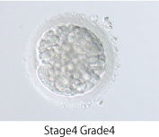 卵子や胚の観察・グレーディング
