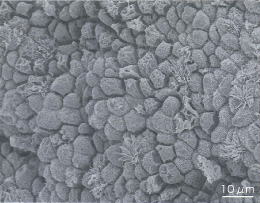 Normal endometrium with regular arrangement of pinopodes [electron micrograph] 