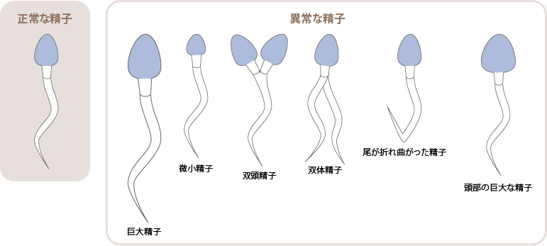 精子の形