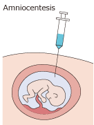 Collect amniotic fluid