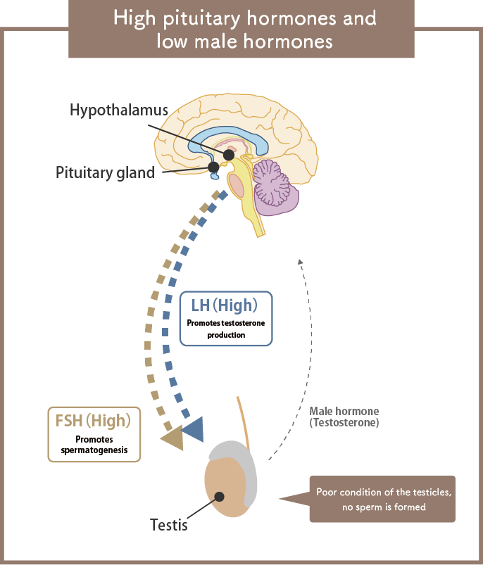 High pituitary hormones and low male hormones