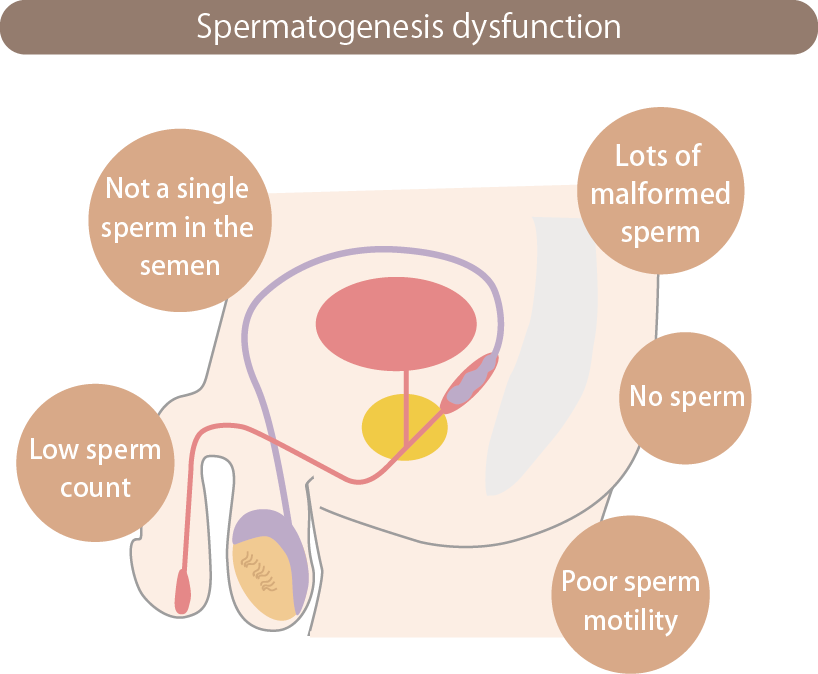 spermogenesis dysfunction