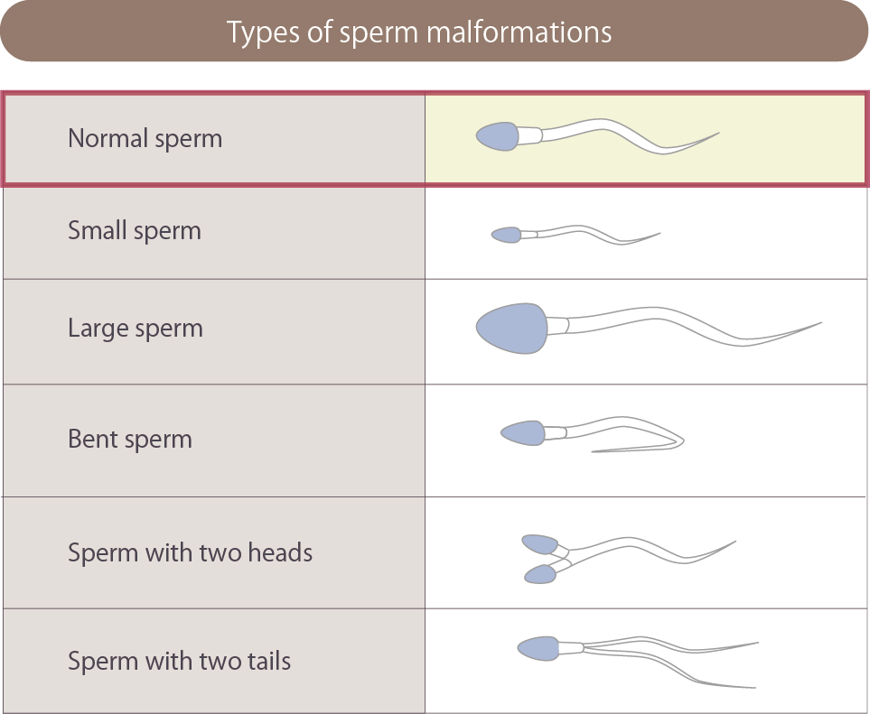Sperm Malformation