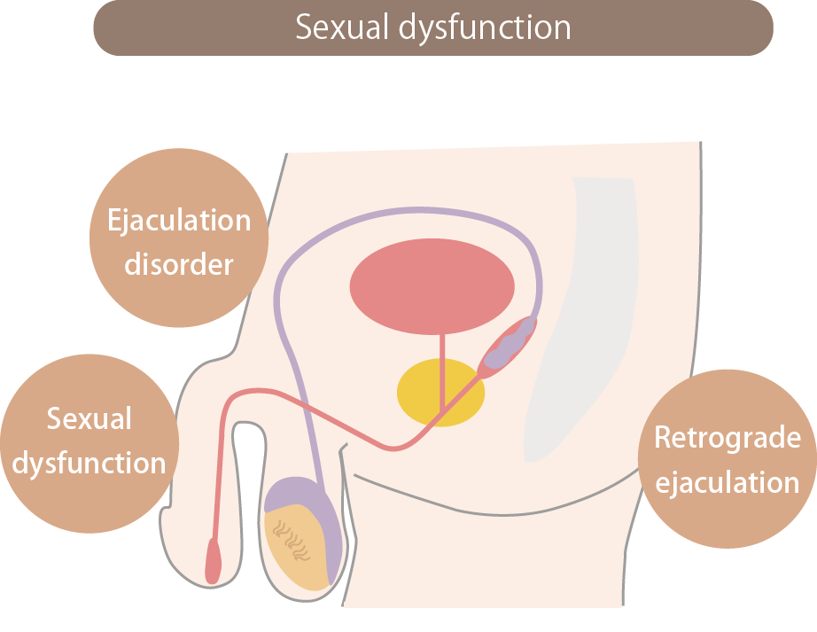 sexual dysfunction