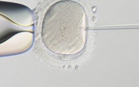 顕微授精に於ける男性の年齢が妊娠率に及ぼす影響