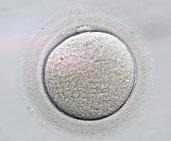 新しい卵巣刺激方法について