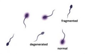 精子の前進運動に関わる遺伝子TDRG1