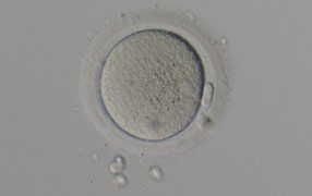 卵巣機能不全への遺伝子治療