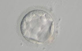 胚のグレード別やDay5及びDay6での妊娠率、着床率