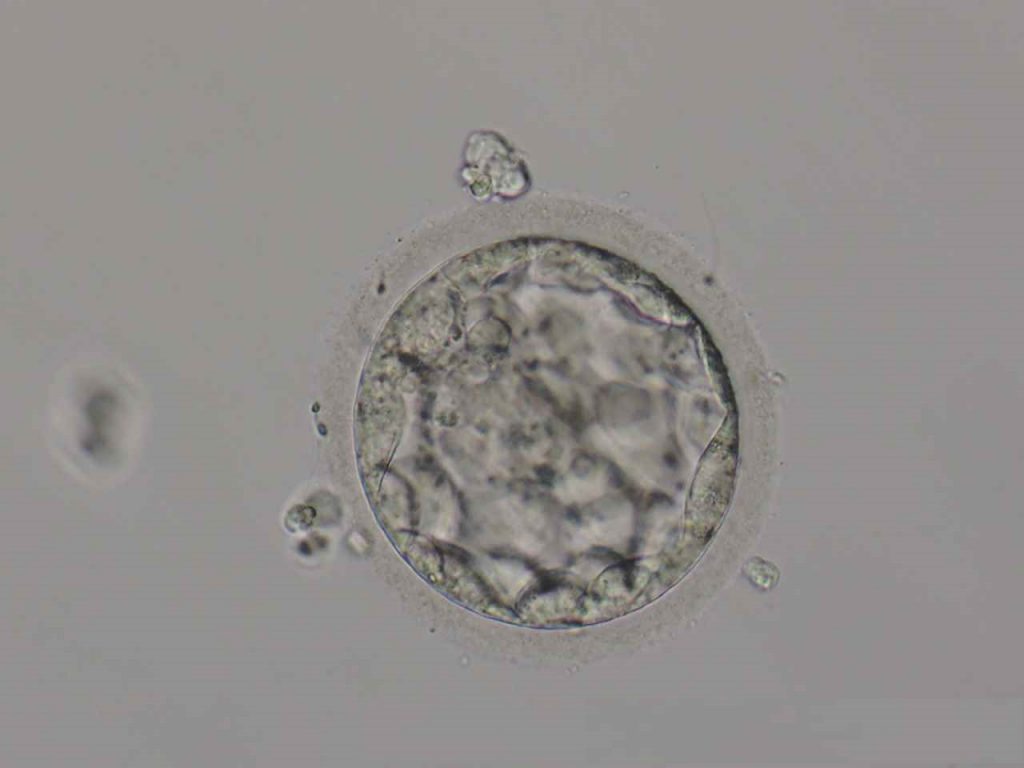 低グレード胚盤胞の妊娠 出産例 医療法人オーク会 不妊ブログ