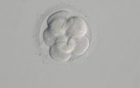 培養3日目の細胞数と妊娠成績