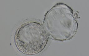 胚の再凍結