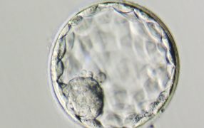 卵巣予備能の低下と胚の染色体異数性との関連
