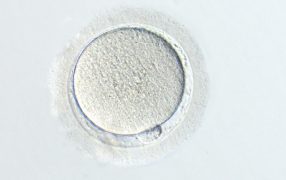 コエンザイムQ10は高齢女性のIVM卵の染色体異数性を改善する