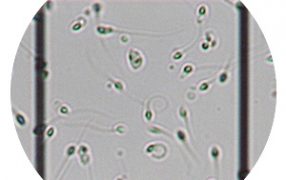 精子の質を改善するサプリメント：コエンザイムQ10