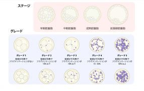 Oak Journal Review： 移植時期にPodocalyxinが減少し着床可能となる