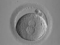 卵子の極体生検で卵子の染色体異常の推測が可能である | 医療法人オーク会 不妊ブログ