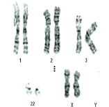 顕微鏡で見た染色体
