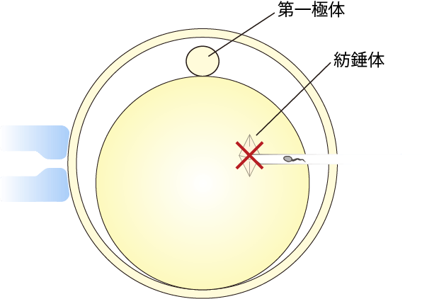 通常の顕微授精