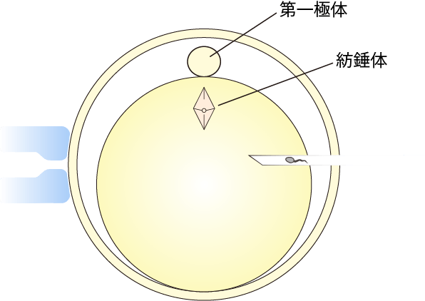 ポロスコープでの顕微授精
