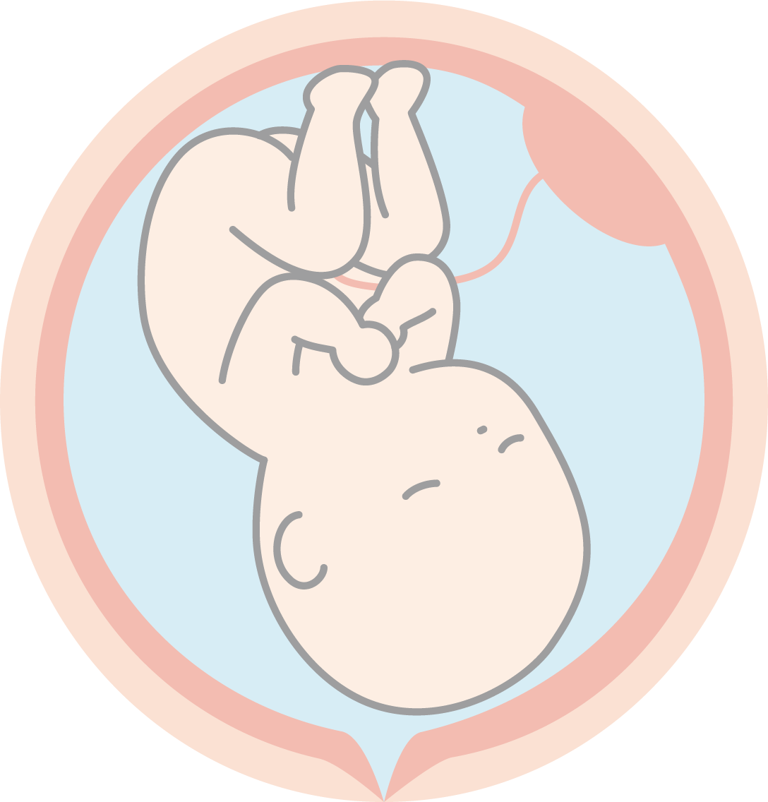 流产后胎儿DNA亲子鉴定