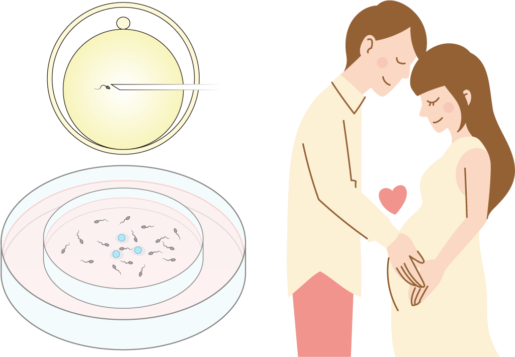 IVF-ETと自然妊娠の比較