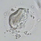 脱水・濃縮した卵子の画像