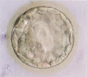 透明帯が菲薄化している胚盤胞