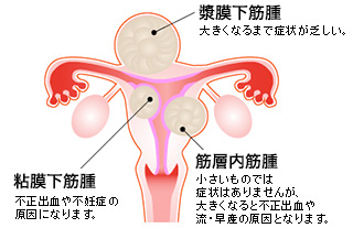 サージセンター 体外受精 医療法人オーク会