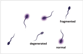 Special Sperm