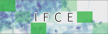 IFCE（子宮内膜再生技術）