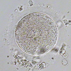 Recovered oocyte after thawing