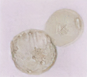 Hatched blastocyst