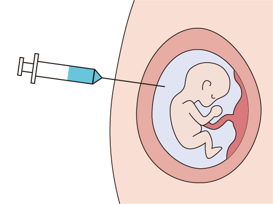 Post-Pregnancy Prenatal Exam