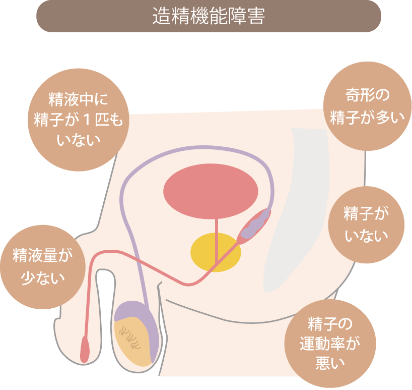 造精機能障害
