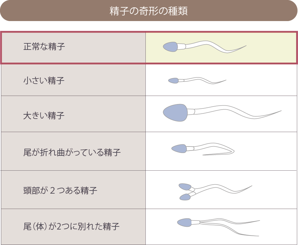 精子奇形症