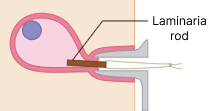 Laminaria rod