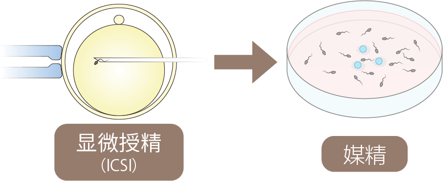 常规显微授精法受精