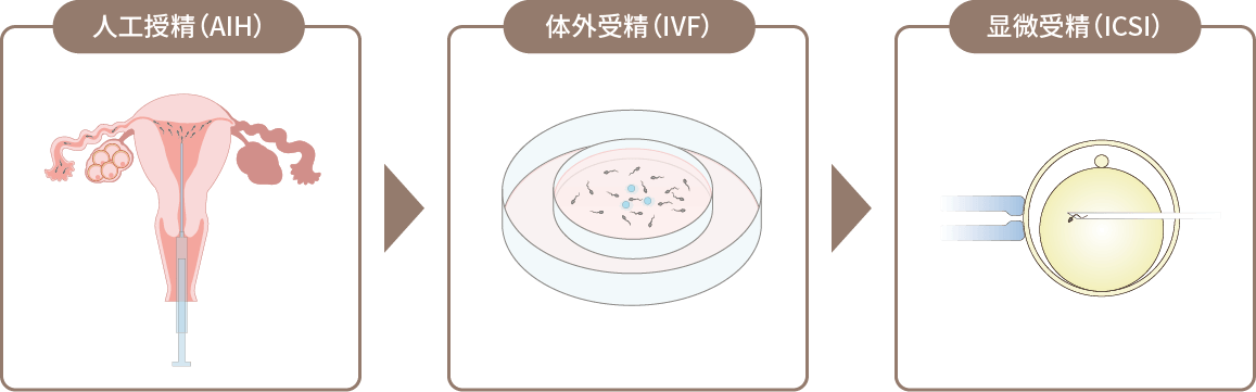 性交后检查（Hühner测试）异常